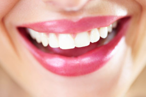 Get fast, professional teeth whitening from William J. Holevas D.D.S.