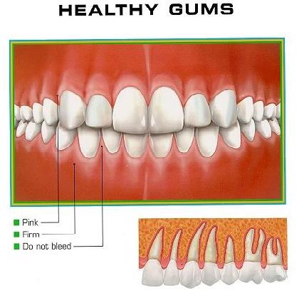 no healthy gums